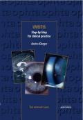 Uveitis Step-by-Step for clinical practice